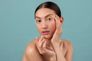 woman after derma filler